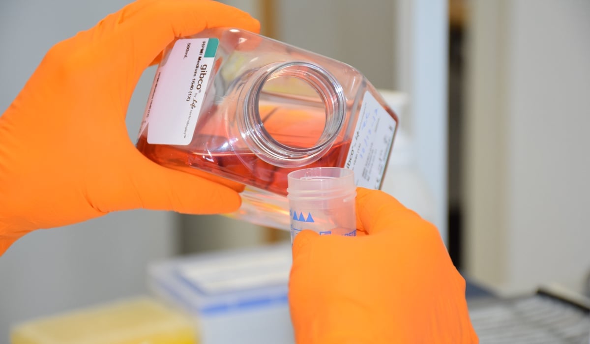 händer i orange handskar häller orange vätska ur flaska . 